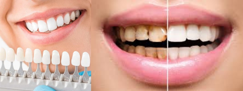 Cosmetic Dentistry