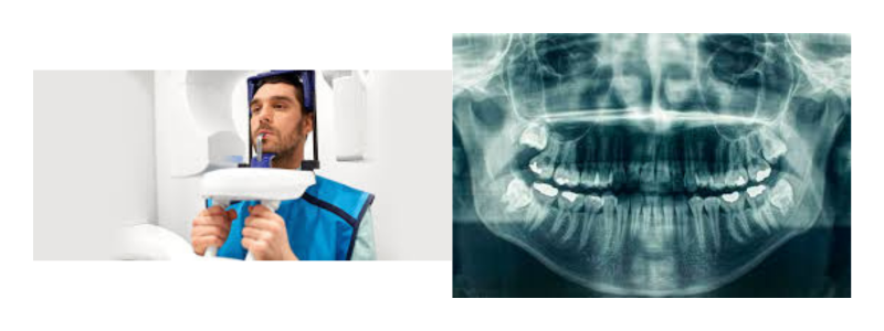 Dental Imaging