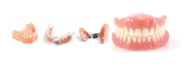 Dental Prosthetics