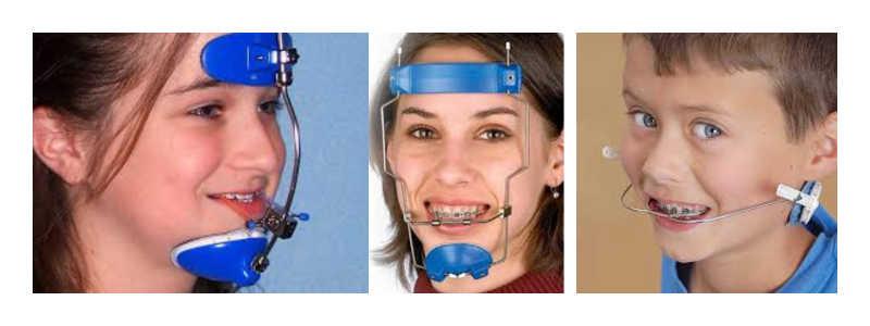 Headgear