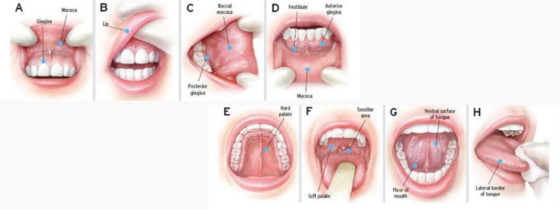 Oral Cancer Screening