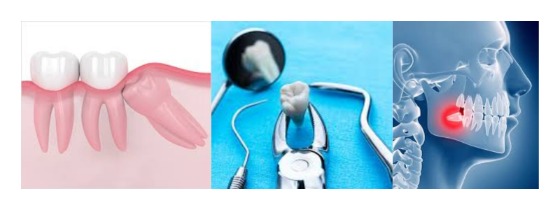 Oral Surgery