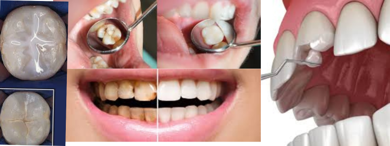 Restorative Dentistry